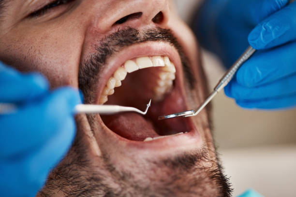 Best Orthodontic Emergency Dentist in Taylorsville, NC